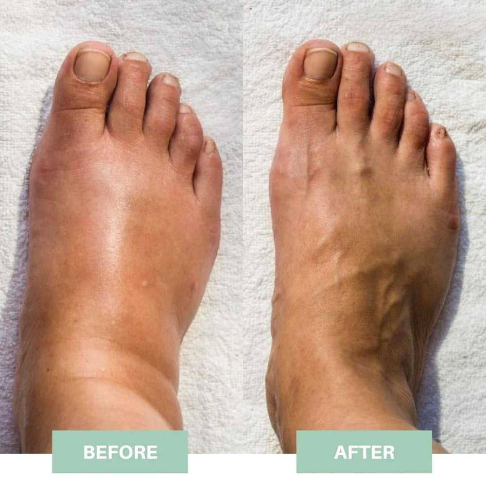 ProFoot™ - EMS Foot Massager